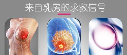 乳腺纤维瘤5厘米需要手术吗 乳腺纤维瘤不切会怎样